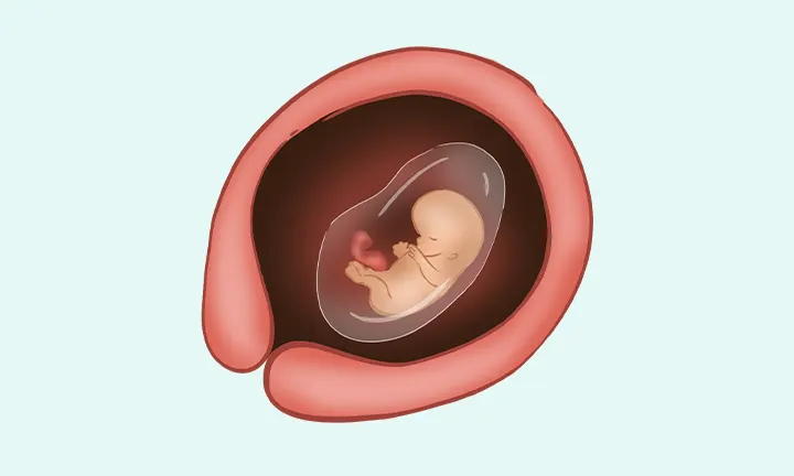 pieluchomajtki dla dorosłych nfz komu przysługuje